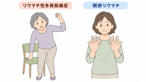 リウマチ性多発筋痛症と関節リウマチの違い